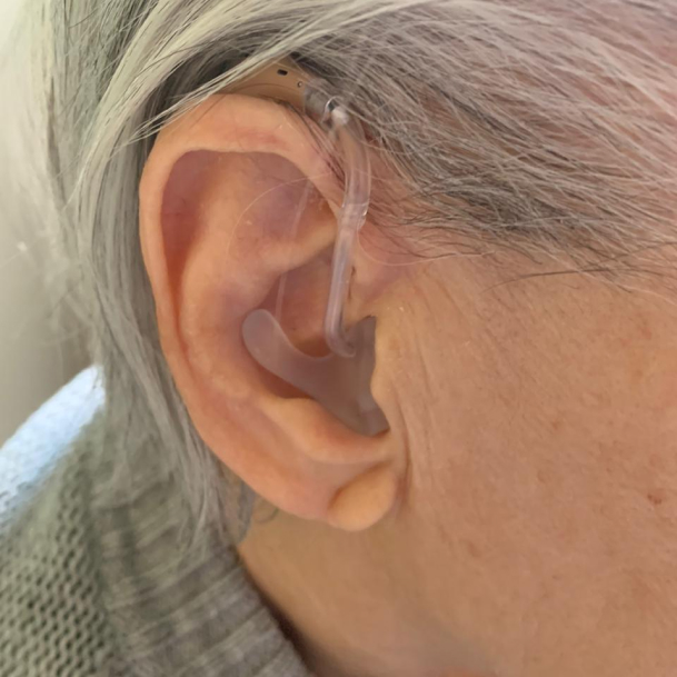 Behind the Ear Hearing Aid with Custom Mold