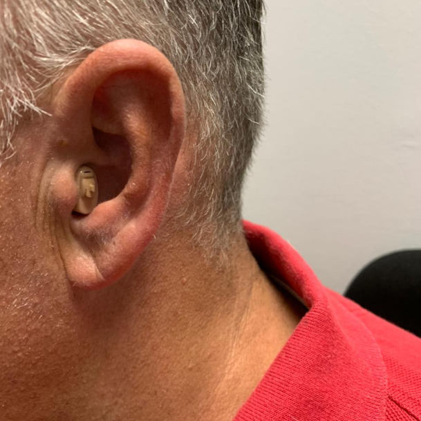 Custom ITE Hearing Aid