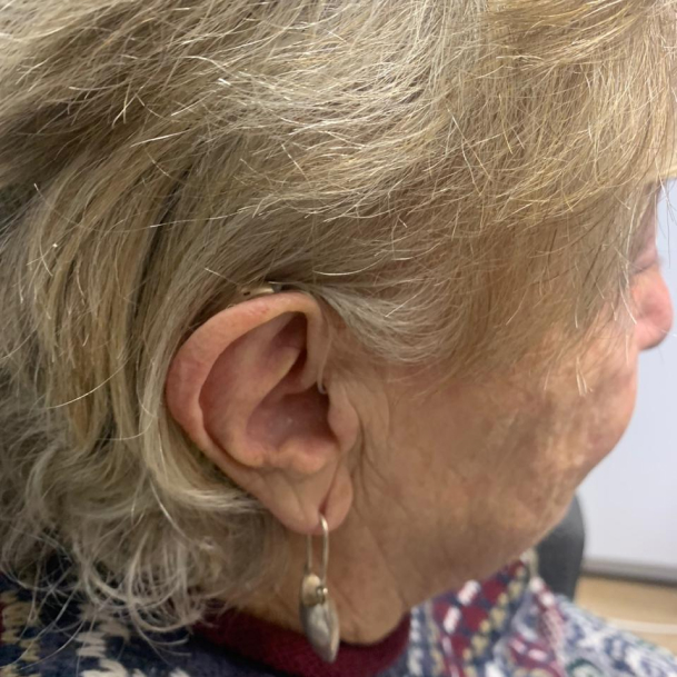 Rechargeable RIC Hearing Aid