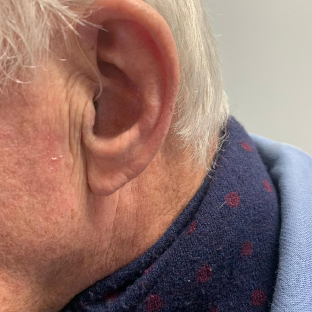 Rechargeable RIC Hearing Aid